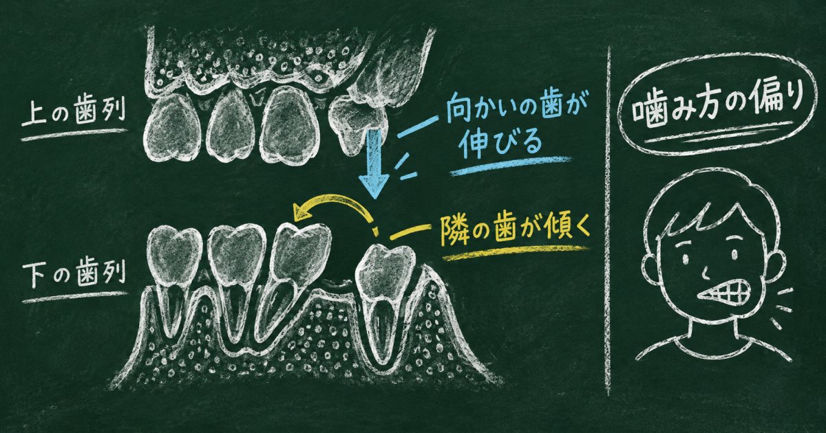 抜いた奥歯をそのままにすると、何が変わりますか？